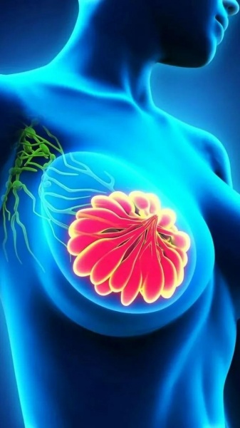 Ученые совершили прорыв в области профилактики рака молочной железы