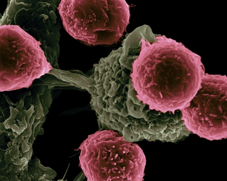 Важность Пап-тестов в борьбе с раком шейки матки