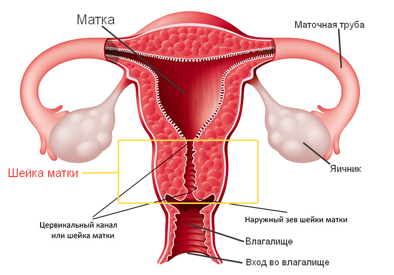 Рак шейки матки: причины появления, симптомы, диагностика, способы лечения и профилактика