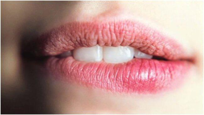 Что такое рак губы: симптомы, виды, современные способы лечения