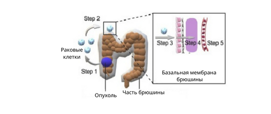 Канцероматоз6 Канцероматоз6