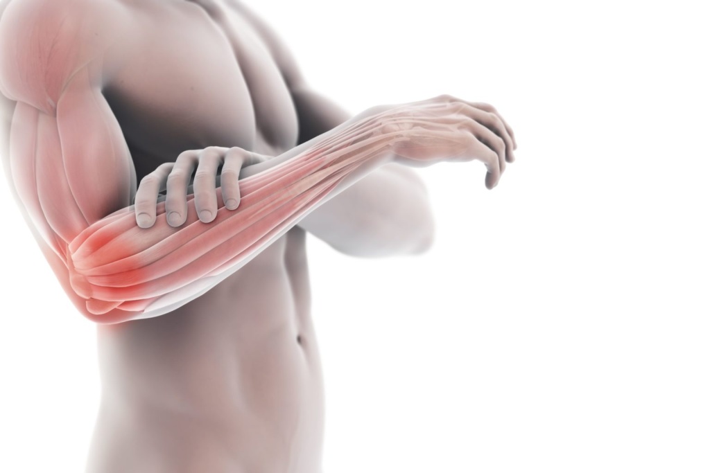 Тендинит Тендинит