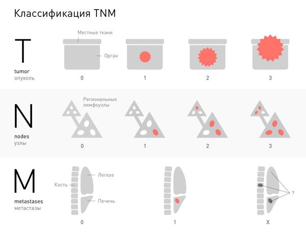 Метастазы4 Метастазы4