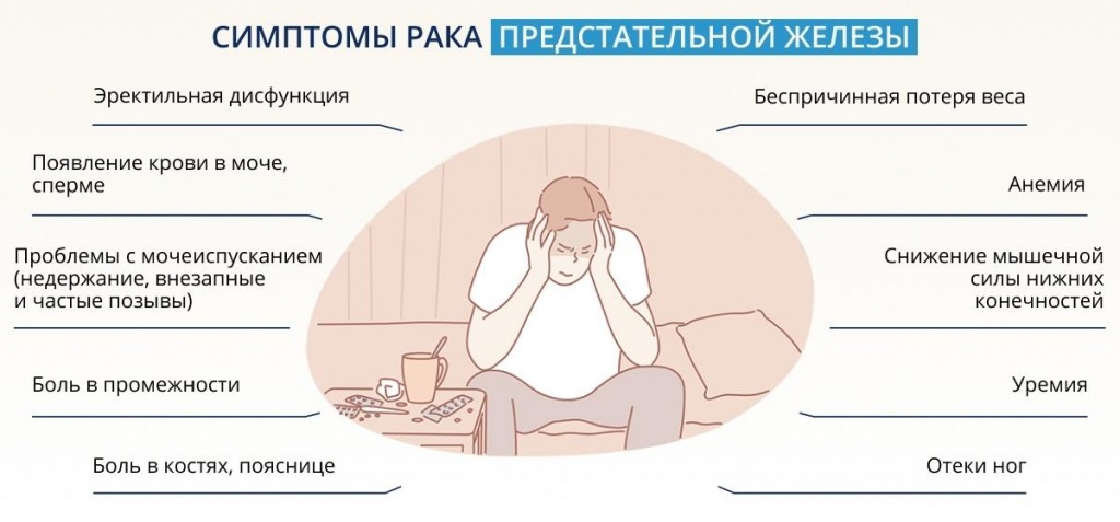 РакПредстательной5 РакПредстательной5