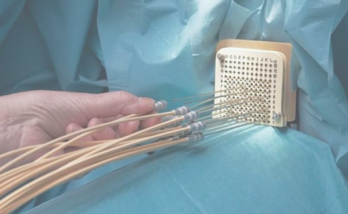 ЛучеваяТерапия2 ЛучеваяТерапия2