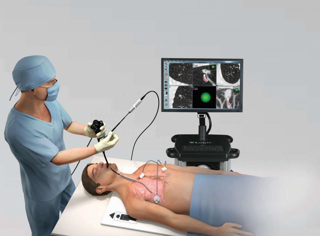 Трахеобронхоскопия Трахеобронхоскопия