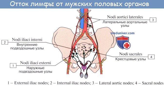 РакПредстательной6 РакПредстательной6