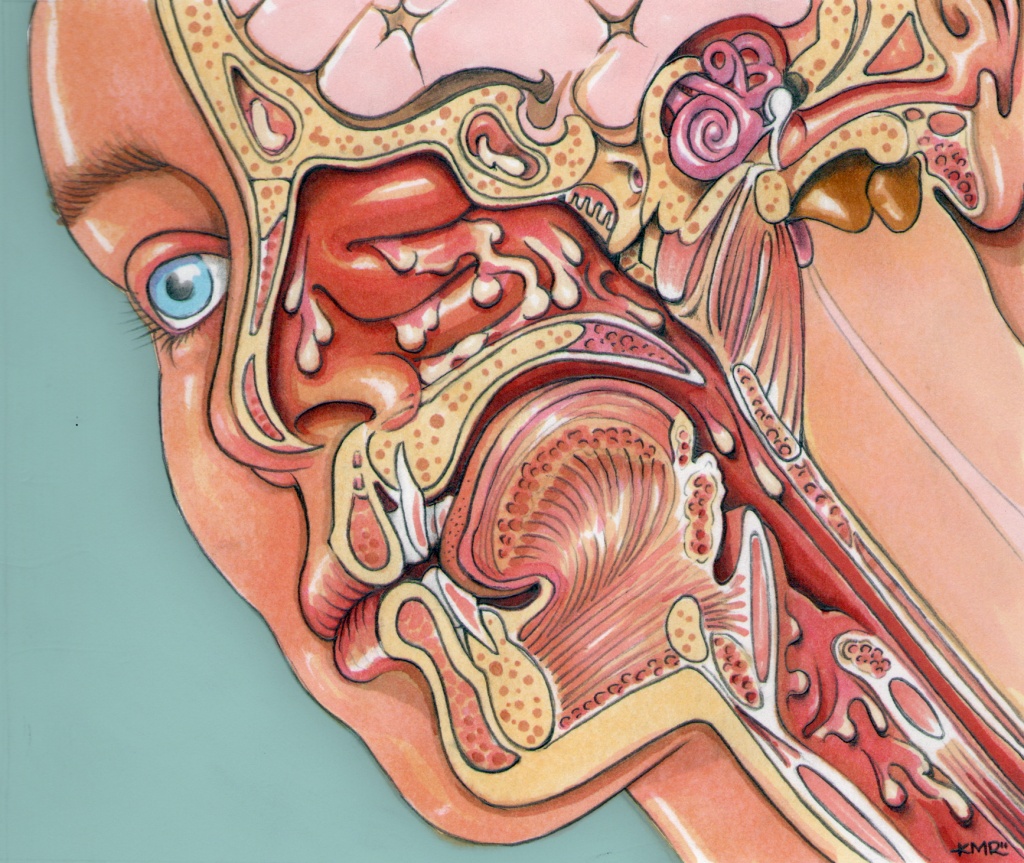 Опухоли ЛОР-органов Опухоли ЛОР-органов