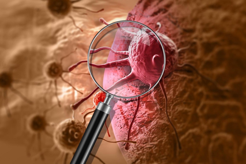 Оливки2 Оливки2