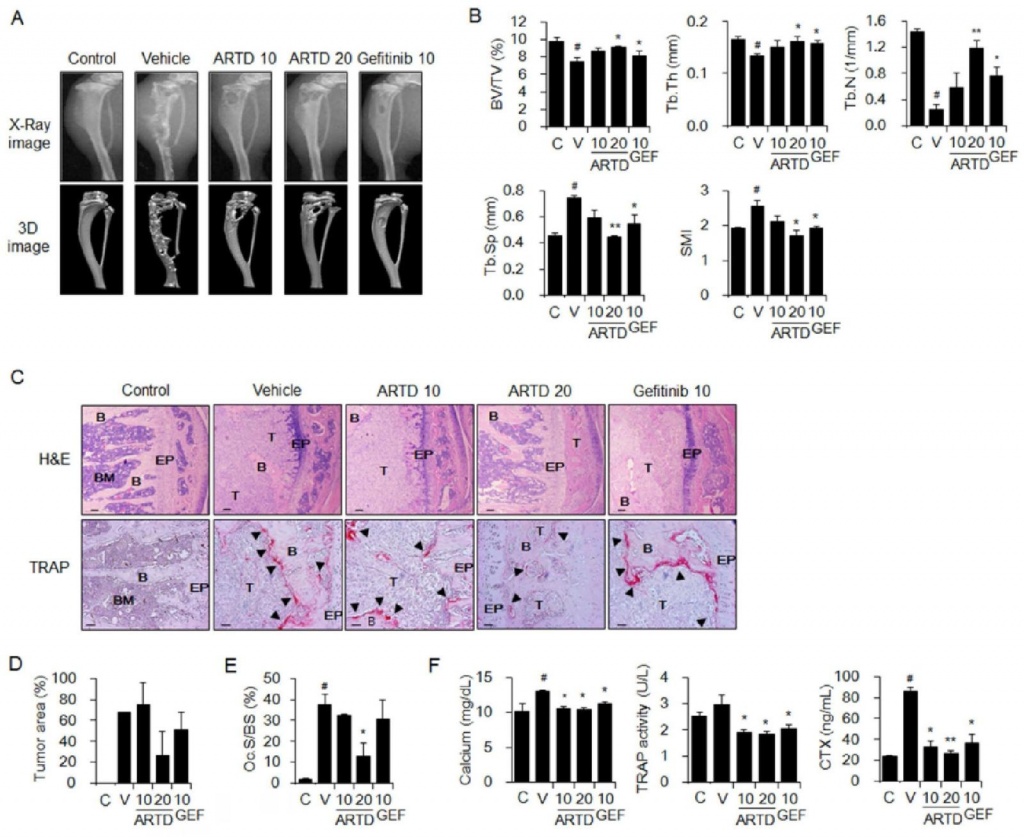 АнтиракАктив2 АнтиракАктив2