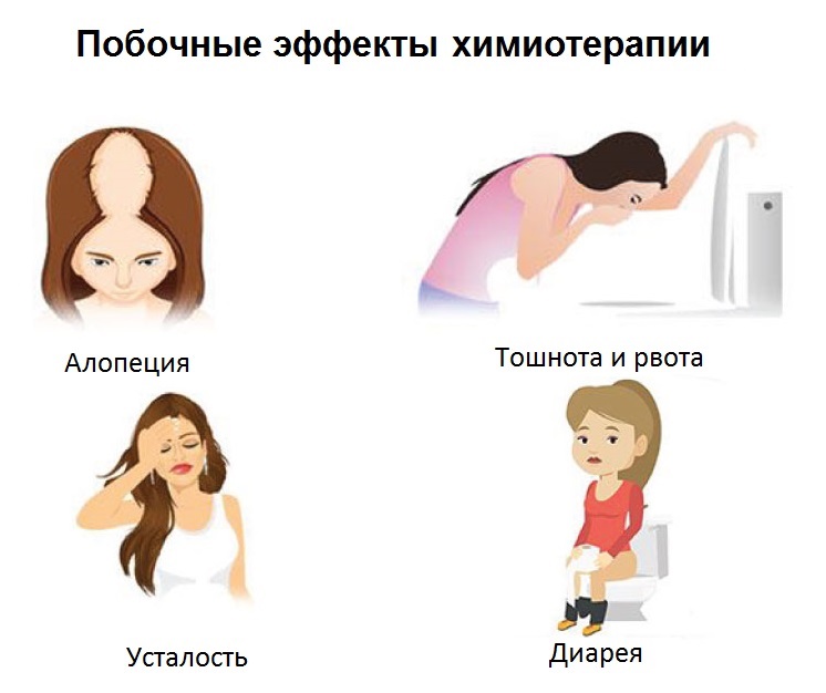 ХимиоПриРаке3 ХимиоПриРаке3