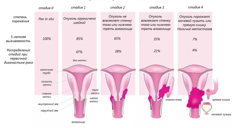 РакШейки5 РакШейки5