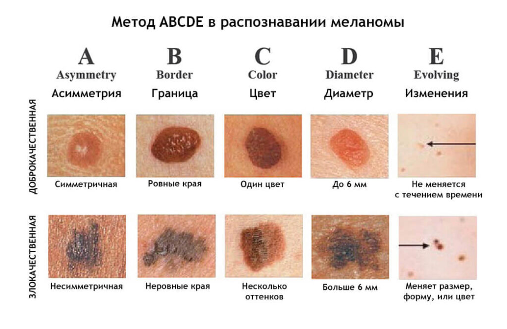 РакКожи9