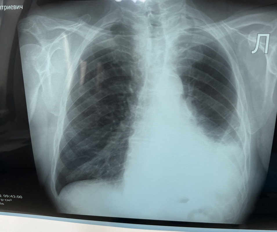 ПослеЛечения ПослеЛечения