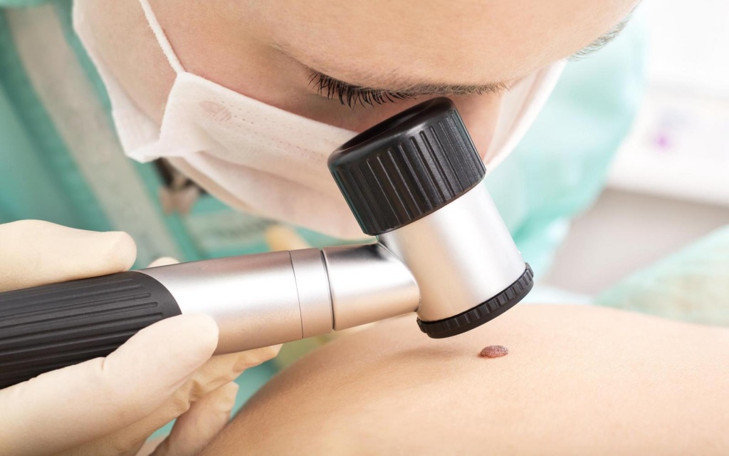 Дерматоскопия Дерматоскопия