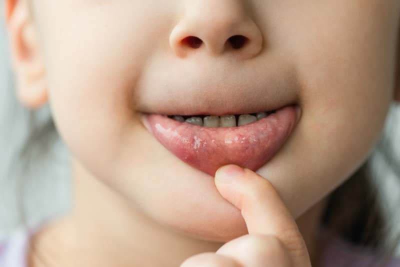 РакГубы6 РакГубы6