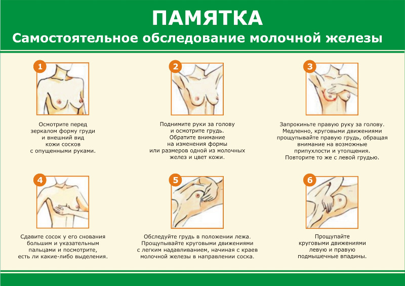 РакМолочнойЖелезы1 РакМолочнойЖелезы1