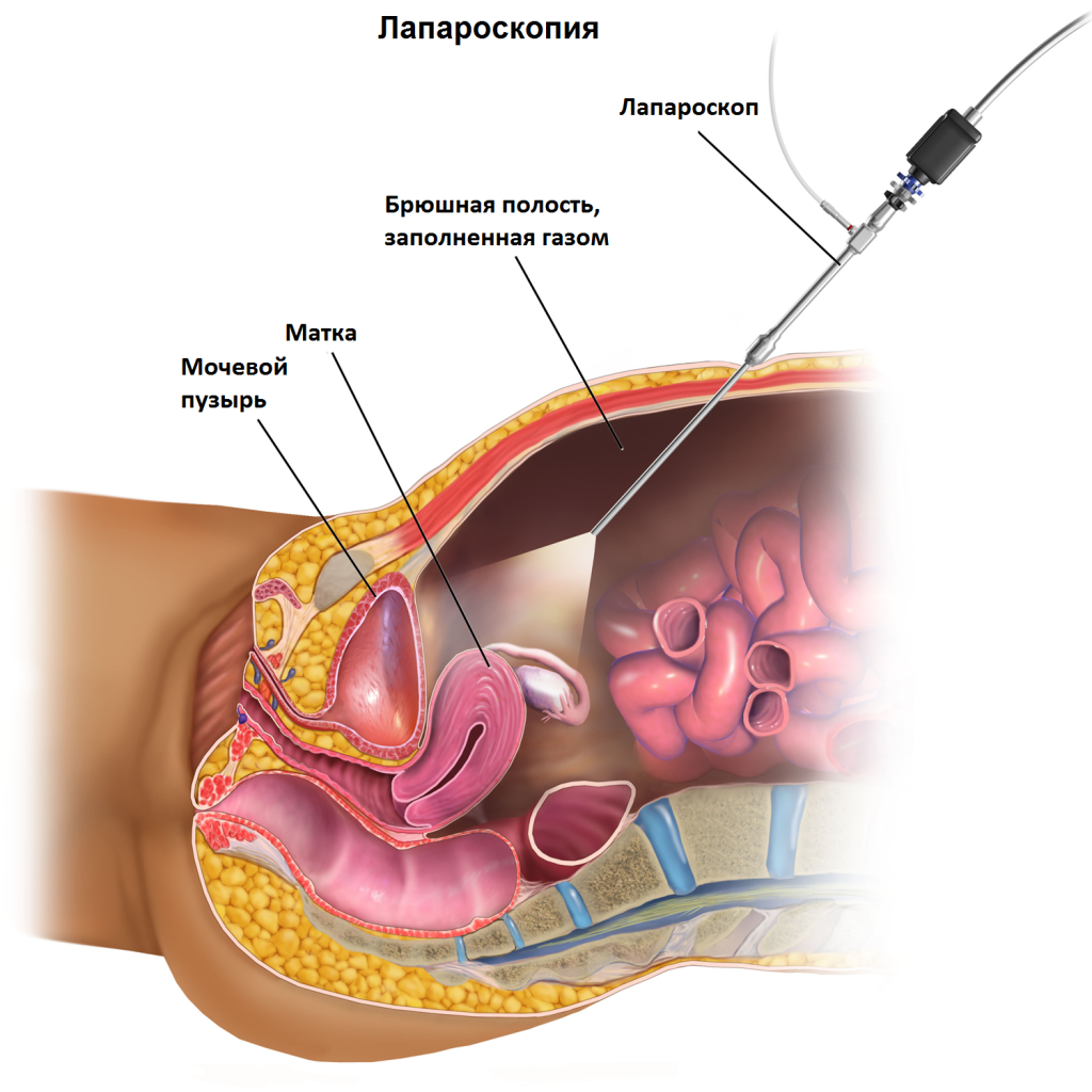 Канцероматоз7 Канцероматоз7