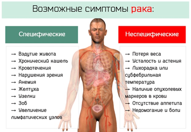 Карцинома13 Карцинома13