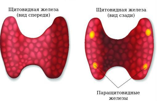 РакЩитовидной4