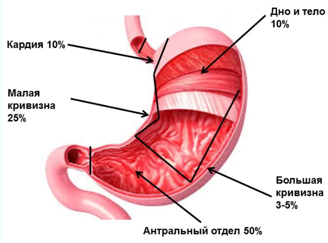 РакЖелудка4